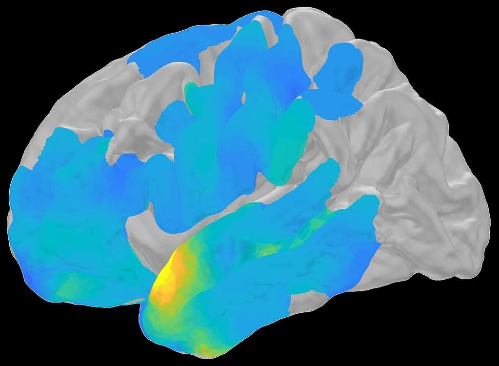 Brain waves