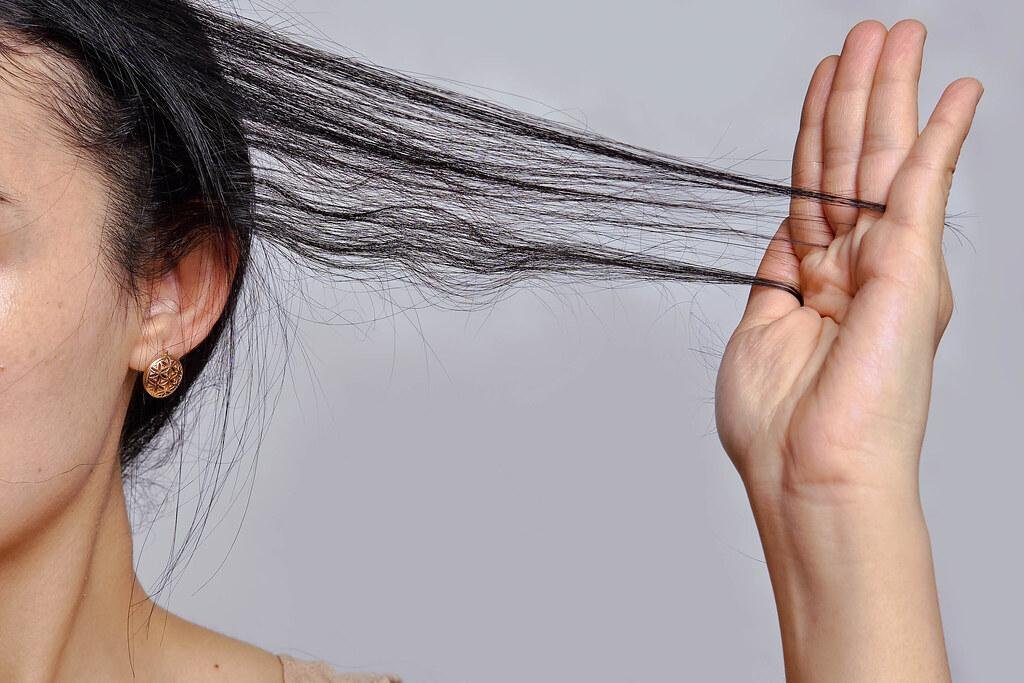 Scalp Health